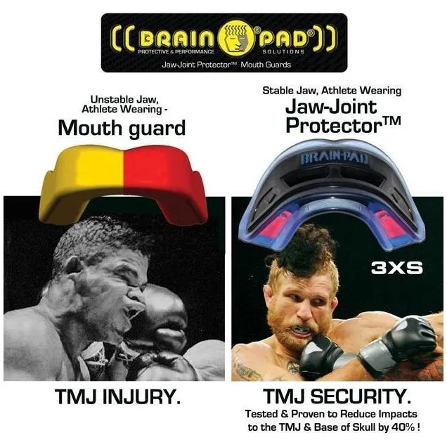 Brain Pad 3XS Mouth Guard